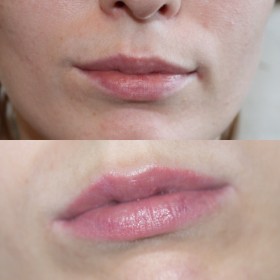 Перманентный макияж губ, до и после. Стойкие, розовые Губы. Использовано два цветы. Розовые Губы. 