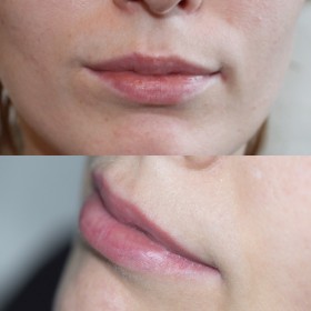Перманентный макияж губ, до и после. Стойкие, розовые Губы. Использовано два цветы.